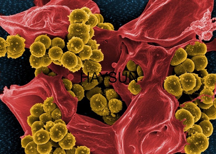 1523583682509804.jpg b5c8ffb918bc141.jpg